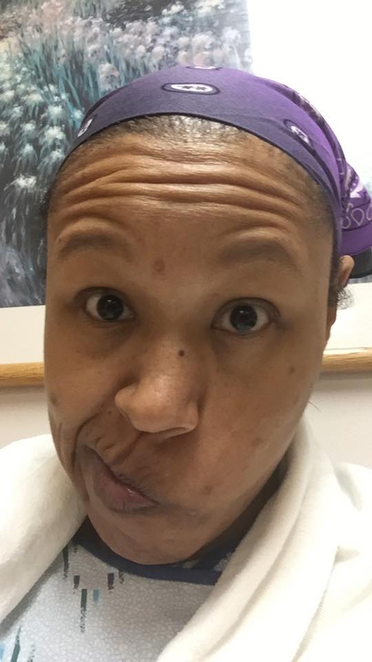 lymph node id